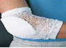 Elbow and Heel Protector